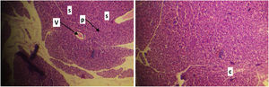 Left: normal pancreatic tissue includes several islets (p) surrounded by many serous acini (s) blood vessels (v). Right: normal pancreatic tissue, connective tissue (c), which also provides a thin capsule to the entire gland and thin septa separating the lobules of secretory acini. H&E 400X.