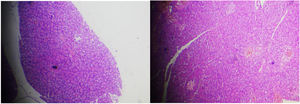 Left: normal pancreas tissue includes several islets surrounded by many serous acini. right: normal pancreas tissue and blood vessels, (H&E 400X).
