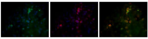 Microscopía de fluorescencia con anticuerpos anti-CD45 (verde), antirreceptor adrenérgico α2 (rojo) y núcleos (azul) (n = 5). Se muestran imágenes representativas con el empalme a la derecha.