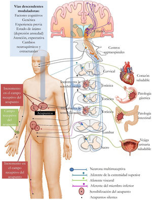 Resumen de las relaciones entre los puntos de acupuntura (C) y los campos de las neuronas multirreceptivas (líneas azules). Las neuronas del asta dorsal de la médula espinal reciben amplias entradas sensoriales de la piel periférica y del aferente visceral, que a su vez envían ramas axónicas hacia los núcleos supraespinales y centrales. El estómago y el colon bajo condiciones inflamatorias aumentan la entrada sensorial hacia la médula espinal. Las neuronas medulares, a su vez, envían proyecciones axonales a niveles supraespinales y mediante mecanismos reflejos a las regiones cutáneas periféricas donde se encuentran los campos receptivos que contienen los puntos de acupuntura. El incremento en el campo receptivo de un punto de acupuntura es el resultado de cambios en la sensibilización visceral y de la médula espinal. El punto de acupuntura cambia de un estado silente a uno sensibilizado, lo que muestra que los puntos de acupuntura son neurodinámicos. Los campos receptivos de acupuntura también están bajo la influencia de la información descendente, que dependen de las condiciones individuales de cada individuo. Adaptado de Quiroz-González et al63.