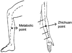 Localization of Dàixiè (metabolic point) and Zhichuan. Adapted from Yin et al.22