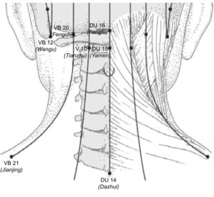 Canales y puntos de acupuntura de la región cervical. Modificado de: Focks C. atlas de Acupuntura. 2.ª ed. Barcelona: Elsevier-Masson; 2009.