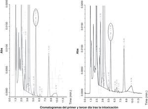 Cromatogramas (HPLC) de las fracciones de 25-OH-vitamina D2 en el primer y tercer día tras la intoxicación.
