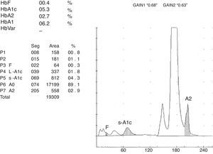 Cromatograma normal por el sistema ADAMSTM A1c HA-8160 (A. Menarini Diagnostics®).