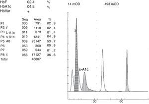 El sistema ADAMSTM A1c HA-8180 (A. Menarini Diagnostics®) detecta una banda anómala identificada como Hb C, cuantificada como un 36,6%. Adviértase la ausencia del pico antes de la banda, como ocurre con la Hb O-Arab de la figura 3.