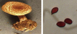 Lepiota bruneoincarnata y sus esporas89.