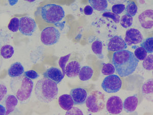 Parásitos de Leishmania sp. en histiocitos de médula ósea. Wrigth 1.000x.