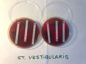 Ensayo de sensibilidad a los antibióticos de un aislado urinario de Streptococcus vestibularis mediante E-test en medio de cultivo de agar sangre de cordero.