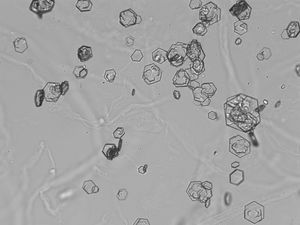 Cristales de cistina.