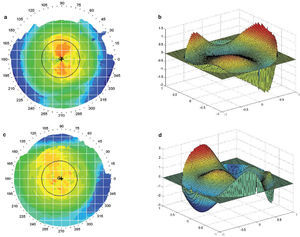 Corneal axial power maps (a+c) and wavefront aberration maps over a 4.5 mm pupil area (b+d) for two subjects. The corneal maps are centered at the corneal vertex with the cross indicating the pupil center.