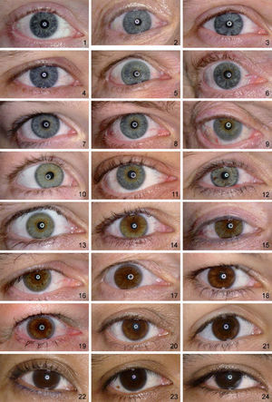 Reference set for classification of iris pigmentation, in order from least (number 1) to most (number 24) iris pigmentation. The presented order is based on ranking by 4 observers. For practical use, this figure can be obtained from the authors upon request.
