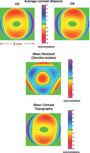 Topography of the mean cornea: Average ellipsoids for right and left eyes (upper panels); average deformation (central panel); and average topography (lower panel). Notice the different scale used for the residual.