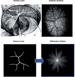 Suture lines and computed diffraction patterns. A plausible explanation of star images (see text).