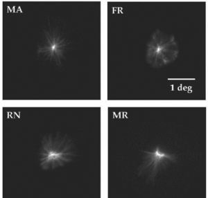 Retinal images of point objects (PSF) recorded in vivo. These images display different pattern star images for each observer. Subject MA shows a high similarity with the computed pattern (see figure 7).
