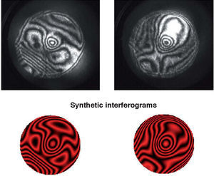 Two examples of interferograms obtained in pig lenses. Upper panels show the experimental recordings; the results of data fit are the synthetic interferograms in the lower panels (courtesy of E. Acosta).