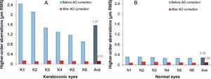 Higher-order aberrations measured for a 5.5mm pupil diameter, in 6 KC eyes (A) and 6 “normal” eyes (B), before and after monochromatic aberration correction by means of the adaptive optics system.