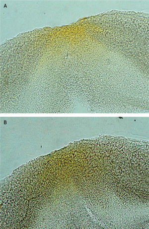 Histological section illustrating the spatial profile and pre-receptorial location of MP, the main location of macular pigment was in the layer of the fibres of Henle in the fovea (a) and in the inner nuclear layer at the parafoveal site (b).