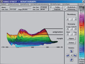 Horizontal 3D view of curvature changing due to FOKX.