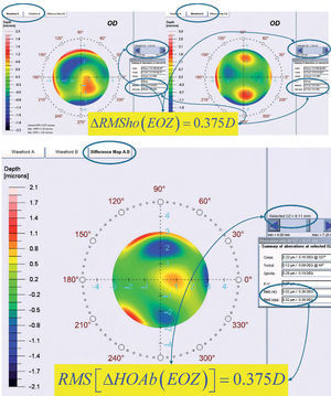Top: Concept of the ΔRMSho method: By comparing postoperative and preoperative corneal Wave Aberrations analyzed for a common diameter starting from 4-mm, we have increased the analysis diameter in 10μm steps, until the difference of the corneal RMSho was above 0.375 D for the first time. This diameter minus 10μm was determining the EOZ. Bottom: Concept of the RMS(ΔHOAb) method: By analyzing the differential corneal Wave Aberrations for a diameter starting from 4-mm, we have increased the analysis diameter in 10μm steps, until the root-mean-square of the differential corneal Wave Aberration was above 0.375 D for the first time. This diameter minus 10μm was determining the EOZ for that case.