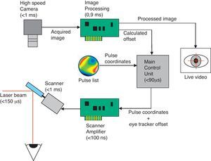 How does an eye tracker work? Usually, eye tracking is solved by machine vision: a camera acquires an image of the eye, an image processing unit searches the pupil and calculates the position as an offset, a laser and scanner control unit adds this offset to the pulse coordinates, finally, a scanner positions the laser beam.