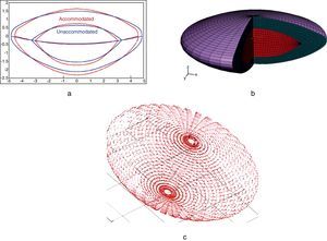 Process to obtain the FE model of the crystalline lens from the parametric geometric model described in Appendix.