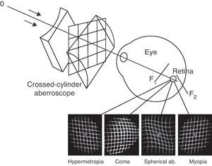 Schematic representation of the cross-cylinder aberroscope and some of the retinal images that can be formed in the retina with different amounts of single aberrations.