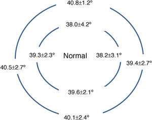 Diagram of the normal eye peripheral angles (at both HVID and 15mm chords).