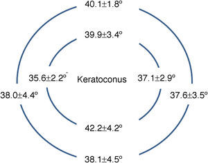 Diagram of the KC peripheral angles (at both HVID and 15mm chords).