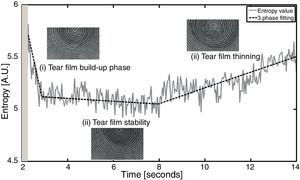 A three-phase example of tear film surface kinetics following a blink.