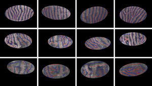 Samples from “healthy” (the first row), “intermediate” (the second row), and “unhealthy” (the third row) images. (For interpretation of color in the artwork, the reader is referred to the web version of the article.)