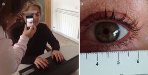 (a) Image capture during real conditions to determine pupil diameter. (b) Image capture of eye with reference rule.