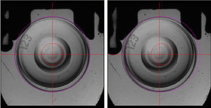 Example of Acuvue BF lens when well aligned (left) and the same lens when deliberately decentered by +0.5mm (right).