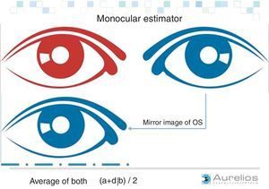 Enantiomorphism of the face. The left and right eyes show mirror symmetry with respect to the nasal axis. (Image courtesy: AURELIOS AUGENZENTRUM.)