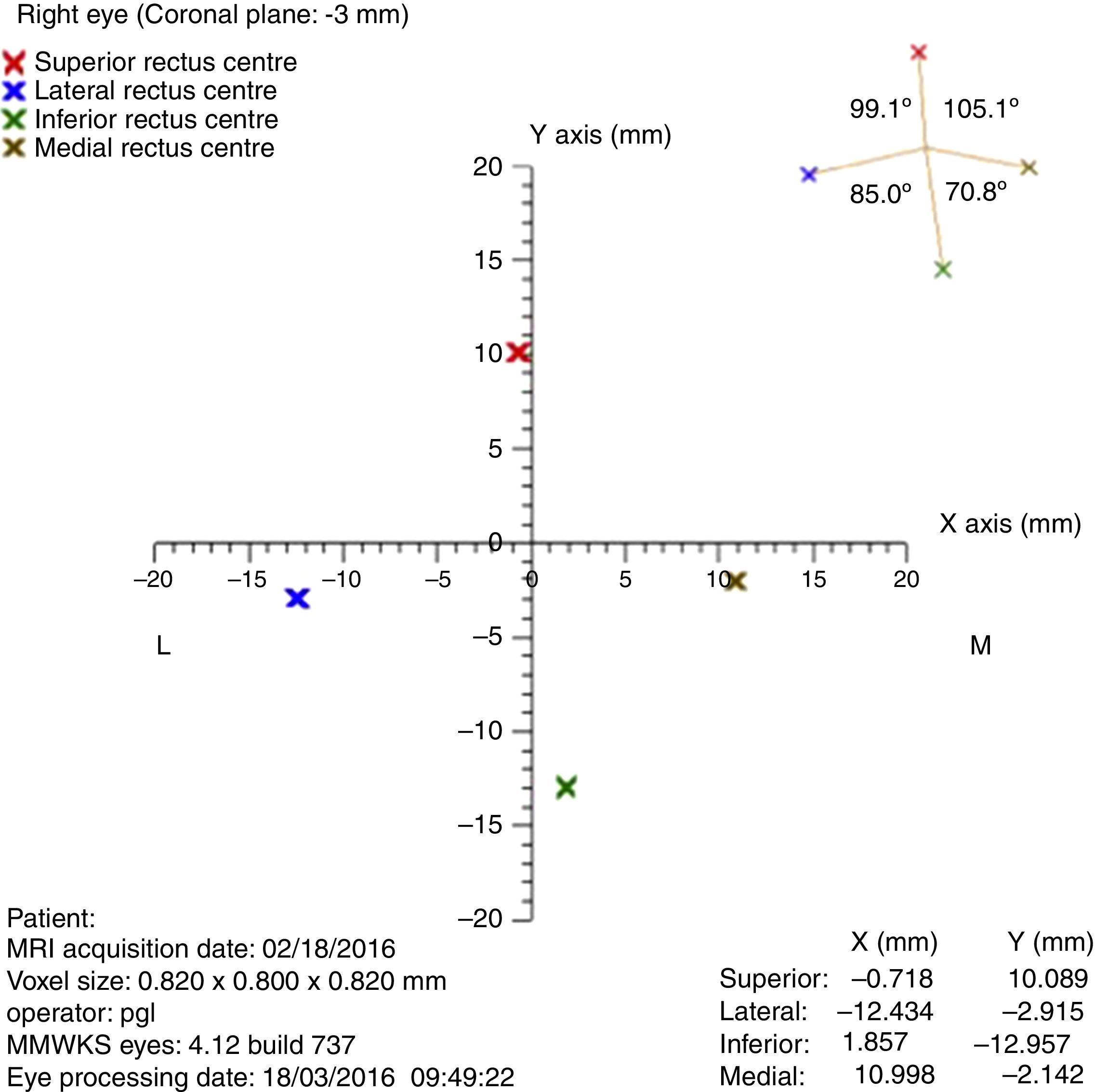 Interocular Distance Mri Orbital magnetic resonance imaging is useful in age-related distance ...