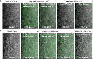 (A) Representative sample cornea with larger cell size and low cell size variation (CV<32), before (ungraded) and after fully-automated, semi-automated or manual grading. Endothelial cell density (ECD) error between manual methods is 1.4%. Compared to mean manual ECD, error with automated methods is reduced from 231% with the fully-automated method to 4.4% with the semi-automated method by the grader