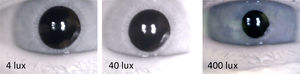 Changes of a pupil under three environmental illumination levels for a subject of 56 years of age.