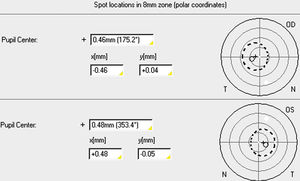 Report of pupil center in Pentacam which is the distance from the vertex normal to the pupil center in Cartesian or Polar coordinates.