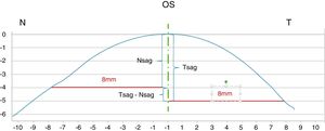 Sagittal height calculation (image from Eye Surface Profiler user