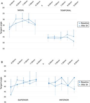 Values of tangent angles from 6.50 to 8.50mm in nasal and temporal regions (horizontal – A) and superior and inferior regions (vertical – B) at baseline and after 3h of ScCL wear.
