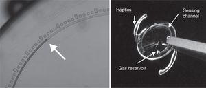 IOL with a microfluidic channel that is open to the aqueous intraocular liquid at one end and connected to a gas reservoir at the end of the channel. This channel has different marks to conduct the measurement.