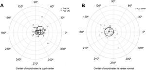 A) Location of the vertex normal from to the pupil center for preoperative and postoperative measures. Black triangles describe the mean and the ellipse around the triangles the standard deviation. B) Location of the intraocular lens (IOL) center to the vertex normal. Black circle describes the mean and the ellipse around the circle the standard deviation. Each ring on the plot describes a 0.2 mm step. Locations are nasal for 0°, superior for 90°, temporal for 180° and inferior for 270°.