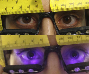 Custom-build infrared light source used for digital pupillometry (Shazly et al.9). The top photo was taken in normal room light with the infrared LEDs turned off. The bottom photo was taken with room lights off and the infrared LEDs turned on.