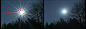 Halos (red circle) and starbursts (red arrow). The image on the right shows these effects reduced.