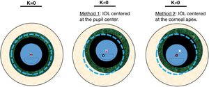 Scheme of the two tested methods. Dotted line represents the corneal diameter, while the small black circle its center. Big texturized ring is the iris, while the white «x» is its center (same than the pupil center). Finally, the intraocular lens is represented by the inner circle with a segmentation in the lower part, while the dot is its center.