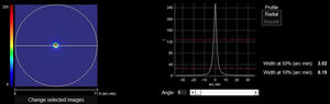 The right side of the image shows the retinal image intensity distribution profile that provides the HD Analyzer™ software. The profile width values are displayed at 50% and 10% of their maximum. The value of the width of the profile at 50% (WP) in minutes of arc (3.02 min of arc in the image) is the metric of optical quality used in the current pilot and phase I study. The higher value, the worse quality of vision.