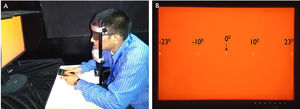 Experimental set up for measuring flicker thresholds in emmetropes and myopes at different retinal eccentricities. (A) The subject is performing the test to identify the location of the stimulus at different retinal eccentricities to measure the flicker thresholds with the help of keypad. (B) The appearance of the screen view when the test is on and the locations of the stimulus present at different retinal eccentricities. The circle in the panel B indicates stimulus locations.