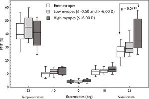 Box and Whisker plots showing median flicker thresholds in emmetropes, low myopes, and high myopes at different retinal eccentricities on the horizontal meridian. The figure indicates higher flicker thresholds in high myopes at all retinal eccentricities compared to emmetropes. Nasal retina FMTs were significantly higher in high myopes than that of emmetropes (p < 0.05, indicated by asterisks*).