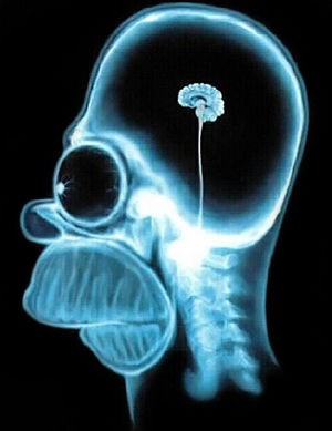 Sagittal T1 MRI of Homer Simpson