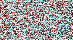 Bueno-Matilla unit random dot test (test 2).