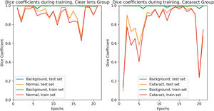 Training curves for the training and test set for clear lens patients and cataract patients.
